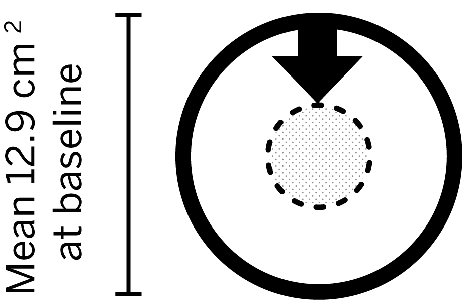 Icon showing that for wounds that achieved >60% reduction in area, the mean baseline was 12.9 cm3