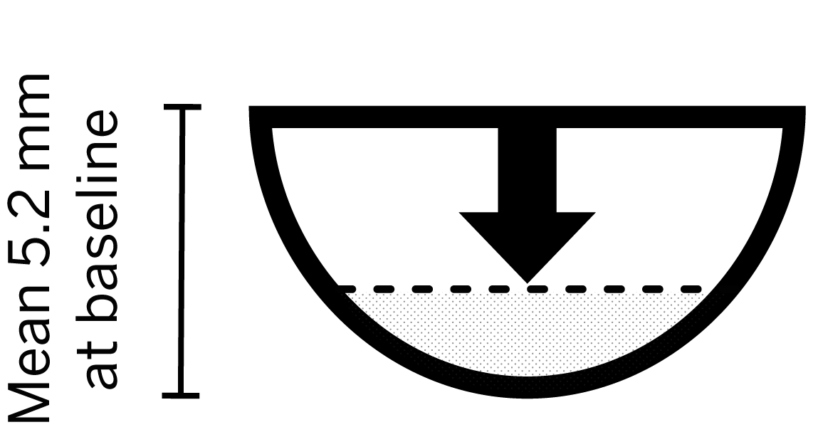 Icon showing that for wounds that achieved >60% reduction in depth, the mean baseline was 5.2 cm3